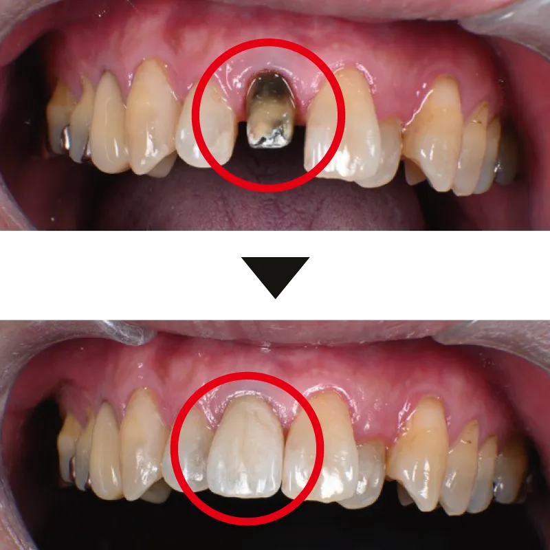 治療症例 53歳男性