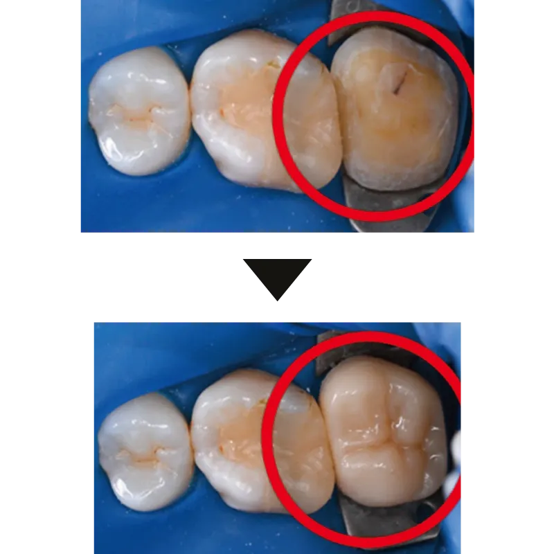 治療症例 45歳女性