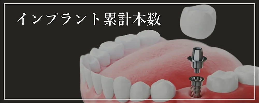 インプラント累計本数